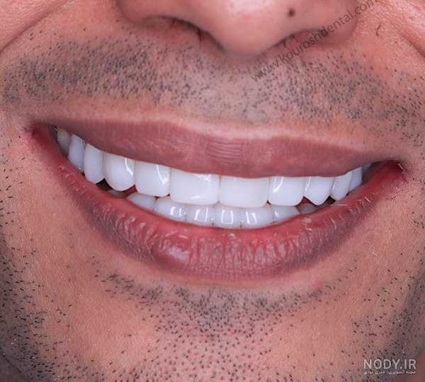 نرم افزار شفاف سازی تصاویر اندروید
