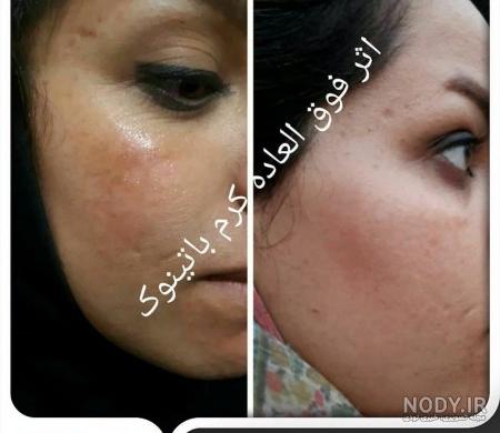 کرم زعفران برای چی خوبه