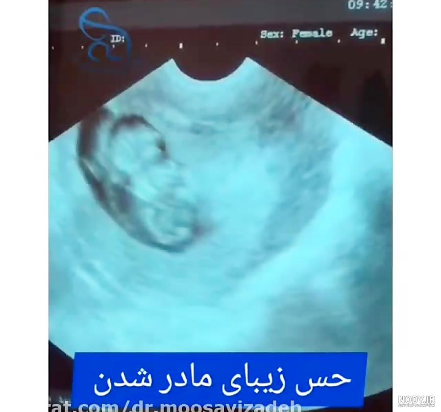 متن اولین سال مادر شدنم مبارک متن اولین سال مادر شدنم مبارک