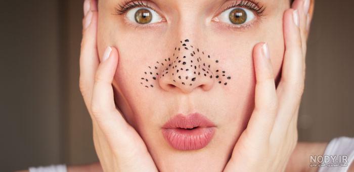 ماسک برای جوش سر سیاه بینی دیجی کالا