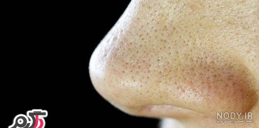 ماسک سیاه برای جوش سر سیاه نی نی سایت