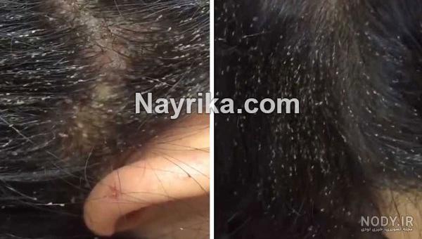 حکم خوردن حبوبات حشره زده