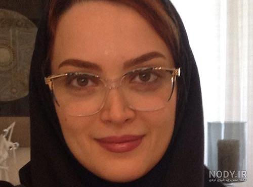 عمل زیبایی مرجانه گلچین