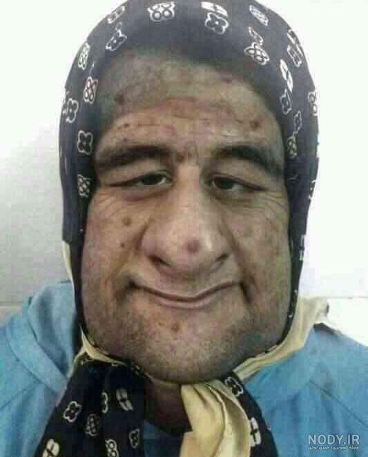 عکس زشت خنده عکس زشت خنده