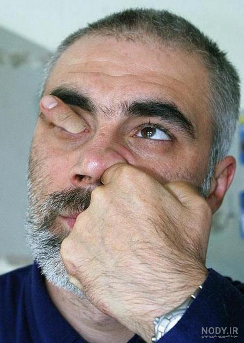 عکس بافتنی ساده