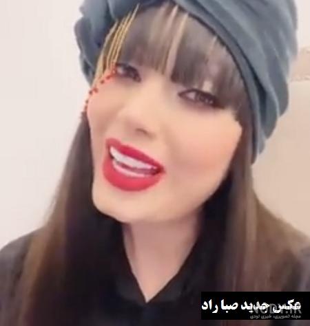 بیماری صبا راد