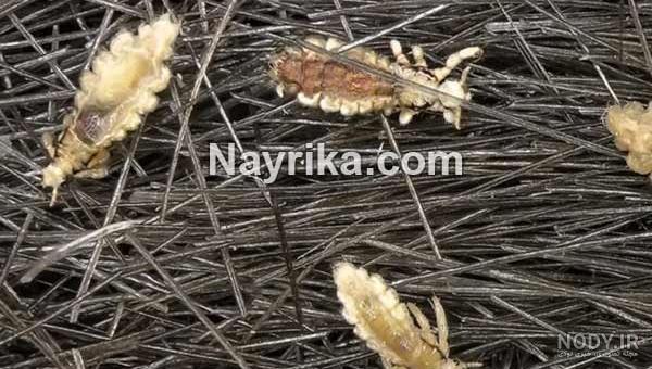 دشمن شپش چیست دشمن شپش چیست