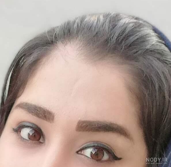 عکس میکرو ابرو نی نی سایت عکس میکرو ابرو نی نی سایت