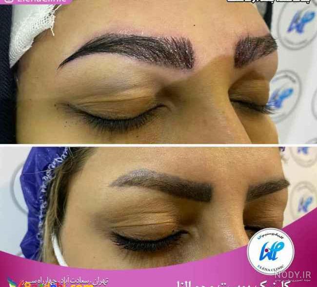 عکس کاشت ابرو نی نی سایت عکس کاشت ابرو نی نی سایت