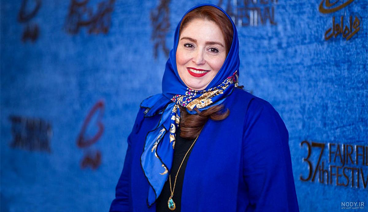 علت چاقی ژاله صامتی علت چاقی ژاله صامتی