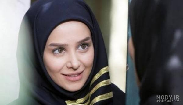 عکس الناز حبیبی قبل از عمل