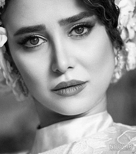 عکس الناز حبیبی قبل از عمل دماغ