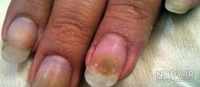 عکس کاشت ناخن ساده و زیبا عکس کاشت ناخن ساده و زیبا
