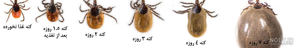 درمان گزیدگی کنه در کودکان درمان گزیدگی کنه در کودکان