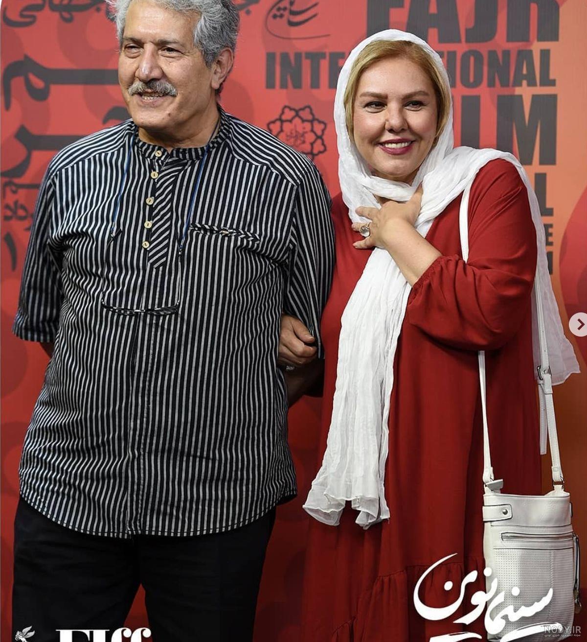 افسانه چهره آزاد قبل از عمل