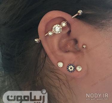 سوراخ دوم گوش
