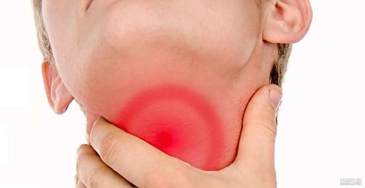 عکس گلوی بیمار کرونایی عکس گلوی بیمار کرونایی