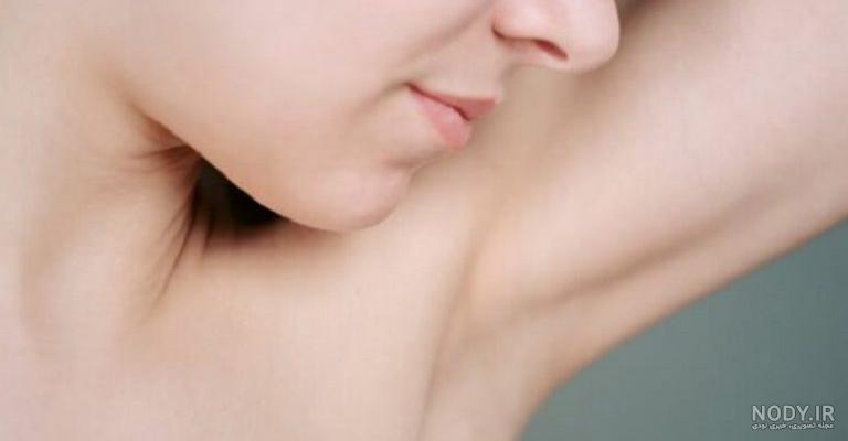 لیزر زیر بغل برای عرق لیزر زیر بغل برای عرق