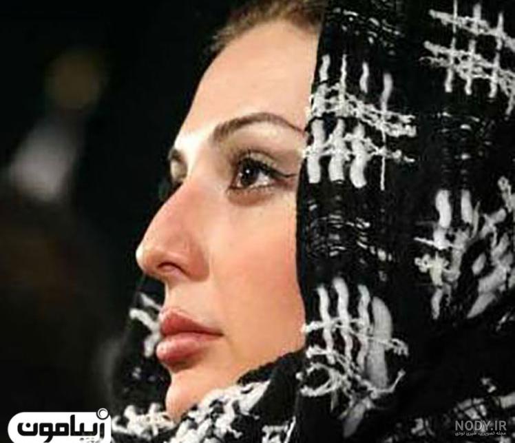 دکتر عمل دوم بینی نیوشا ضیغمی نی نی سایت دکتر عمل دوم بینی نیوشا ضیغمی نی نی سایت
