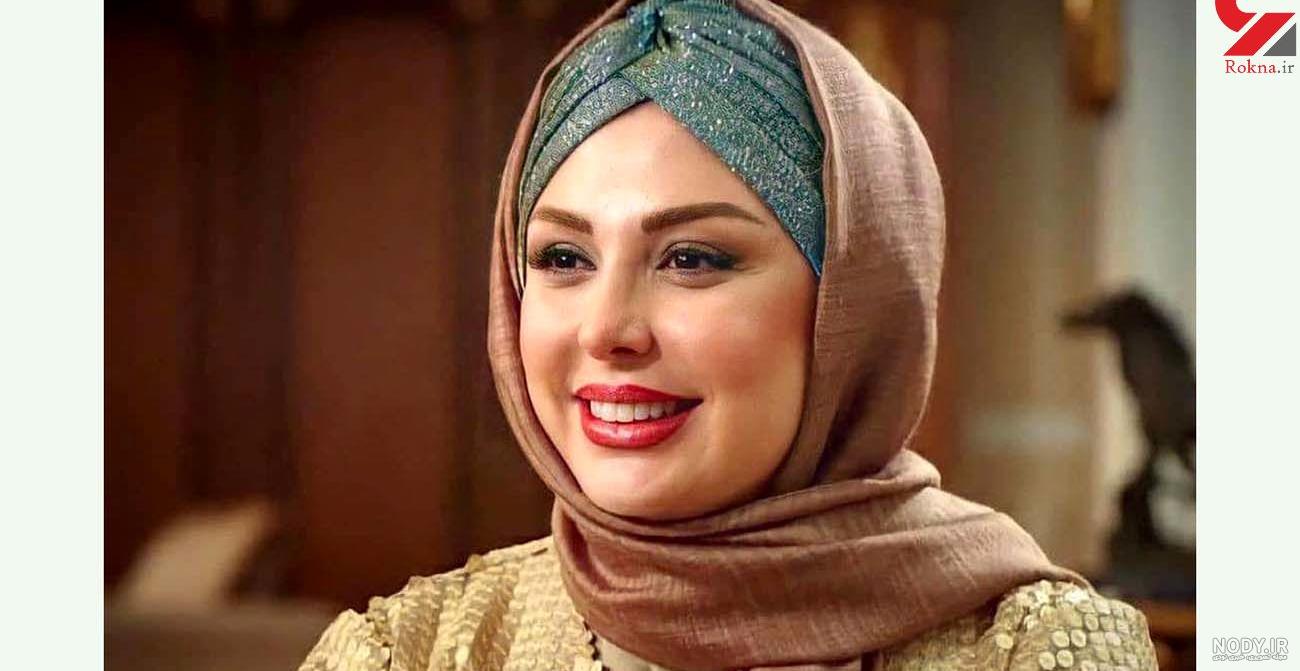 عمل بینی نیوشا ضیغمی قبل و بعد عمل بینی نیوشا ضیغمی قبل و بعد