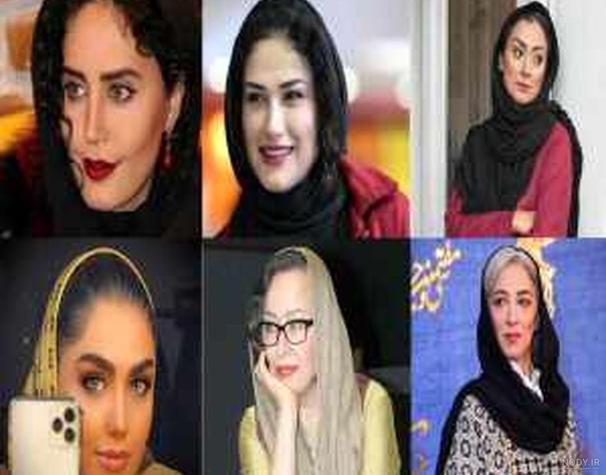 عمل های زیبایی نیوشا ضیغمی عمل های زیبایی نیوشا ضیغمی