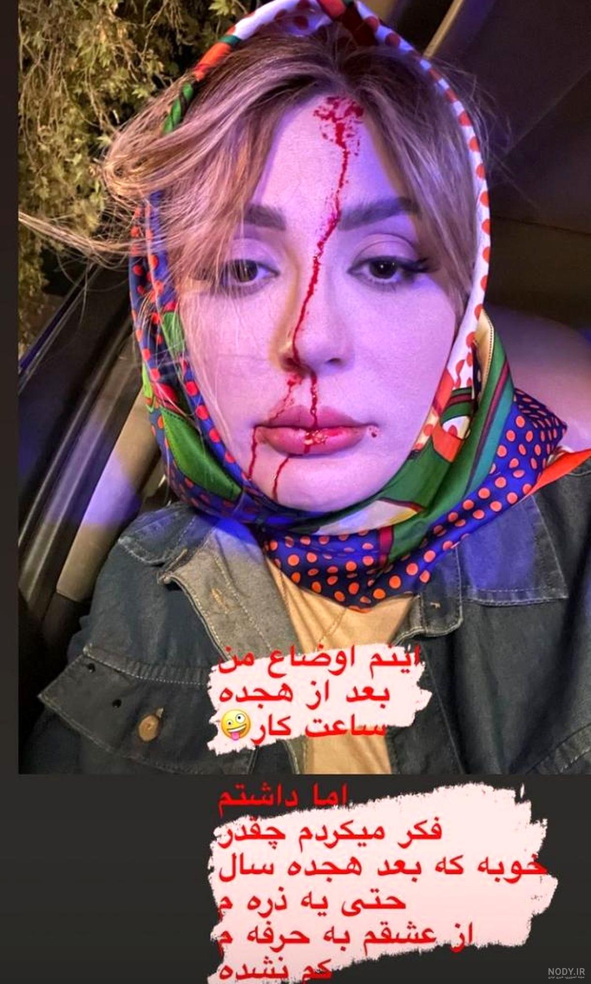 عکس نیوشا ضیغمی بدون آرایش عکس نیوشا ضیغمی بدون آرایش
