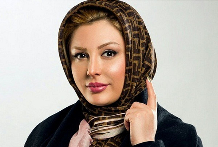 عکس نیوشا ضیغمی قبل از عمل عکس نیوشا ضیغمی قبل از عمل