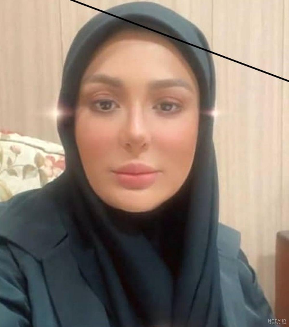 قیافه ی زشت نیوشا ضیغمی بعد از عمل دوم بینی قیافه ی زشت نیوشا ضیغمی بعد از عمل دوم بینی