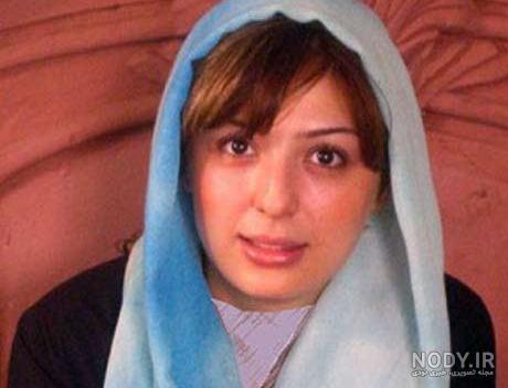 نیوشا ضیغمی قبل از عمل بینی نیوشا ضیغمی قبل از عمل بینی