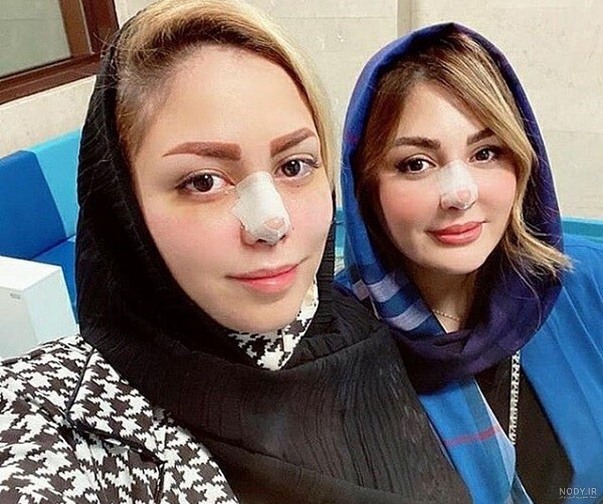 نیوشا ضیغمی قبل از عمل و بعد از عمل نیوشا ضیغمی قبل از عمل و بعد از عمل