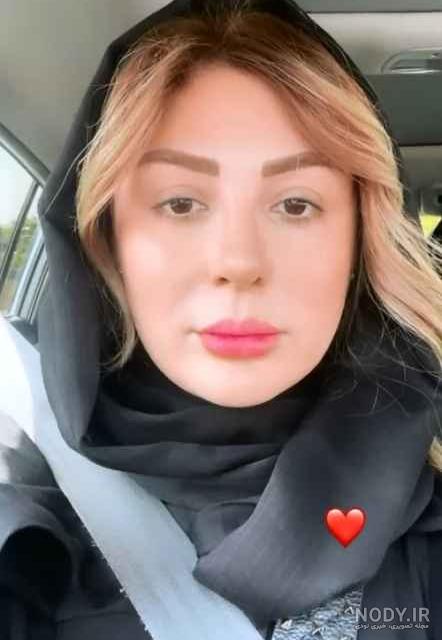 واکنش شیلا خداداد به عمل بینی نیوشا ضیغمی واکنش شیلا خداداد به عمل بینی نیوشا ضیغمی