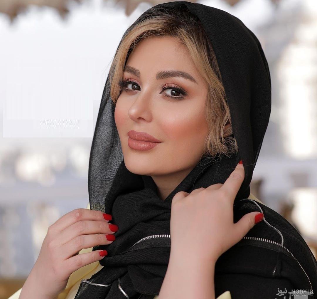 پروتز لب نیوشا ضیغمی پروتز لب نیوشا ضیغمی
