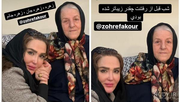 زهره فکور صبور بعد از عمل زیبایی