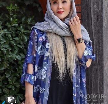 عکس زهره فکور صبور قبل از عمل