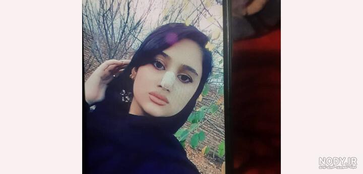 عکس پروف چادر