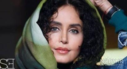 عکس الناز قاسمی قبل از عمل جراحی