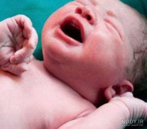 عکس به دنیا امدن بچه از شکم مادر طبیعی