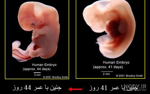 عکس جنین چهل روزه