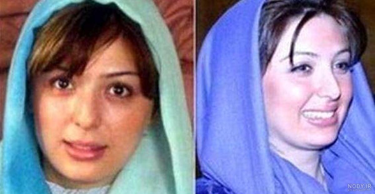 عکس نیوشا ضیغمی قبل عمل جراحی عکس نیوشا ضیغمی قبل عمل جراحی