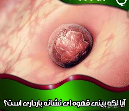 عکس سونو هفته چهارم بارداری