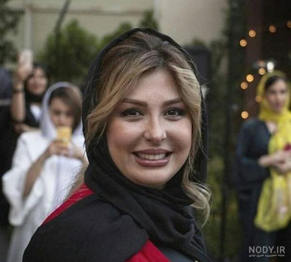 تصاویر نیوشا ضیغمی قبل از عمل بینی