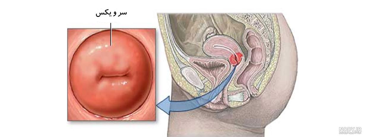 عکس بارداری خارج از رحمی عکس بارداری خارج از رحمی
