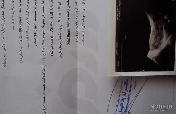عکس سونوگرافی بارداری خارج از رحم عکس سونوگرافی بارداری خارج از رحم