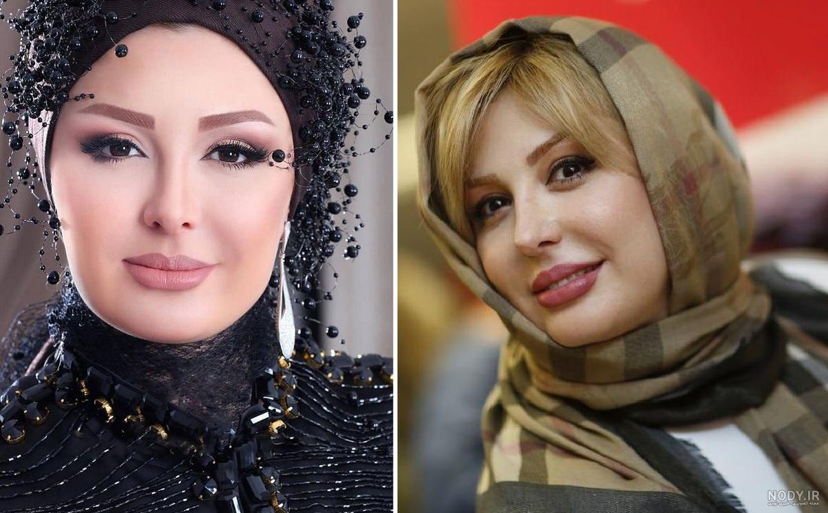 عکس نیوشا ضیغمی بعد از عمل بینی