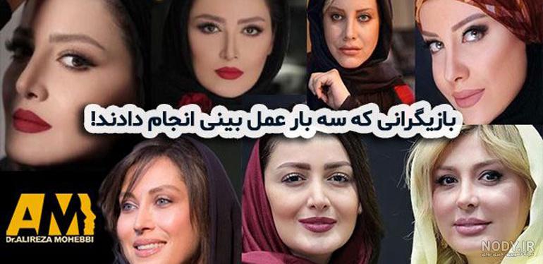 عکس نیوشا ضیغمی بعد از عمل مجدد بینی