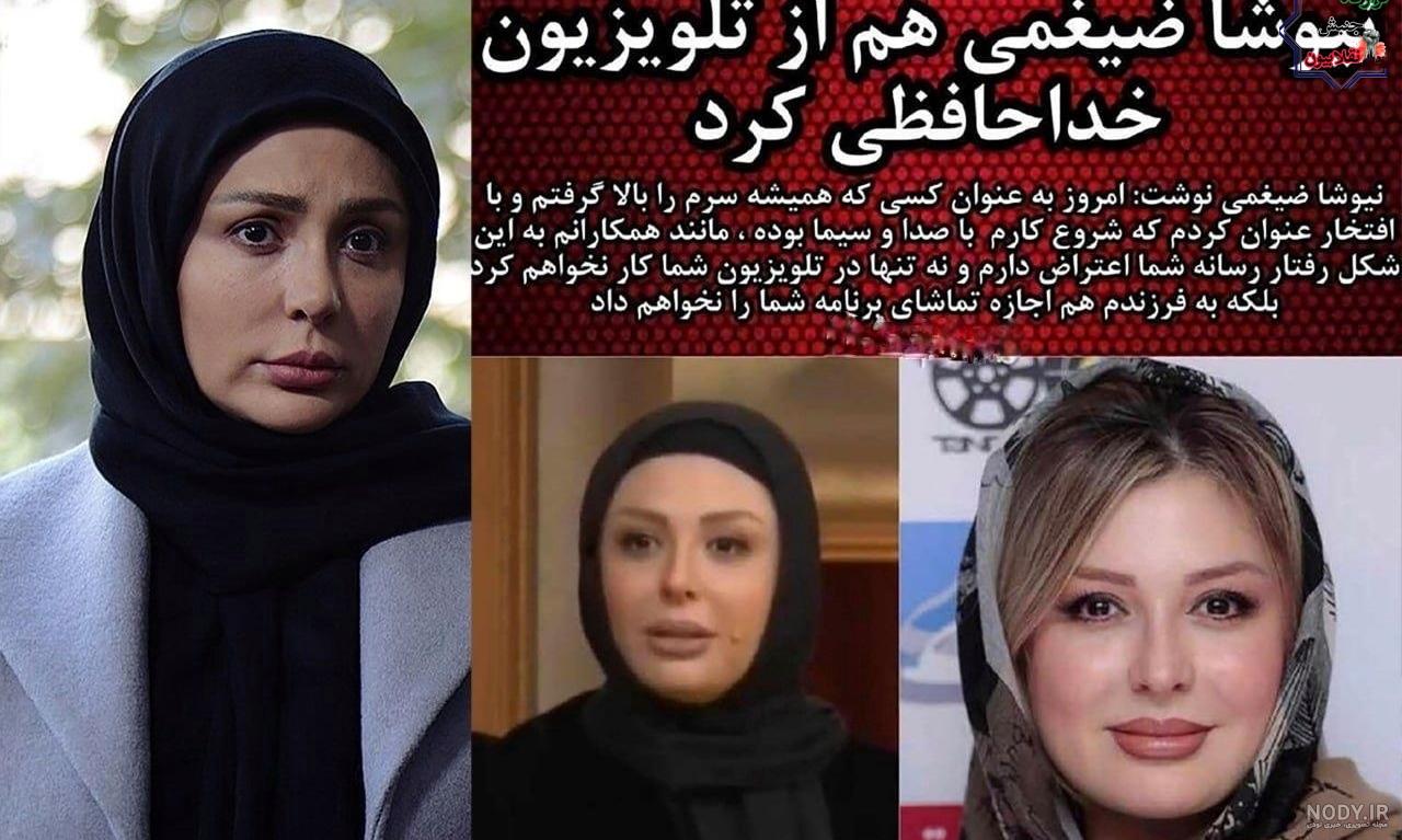 عکس نیوشا ضیغمی قبل از عمل دماغ