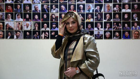 عکس نیوشا ضیغمی قبل عمل بینی