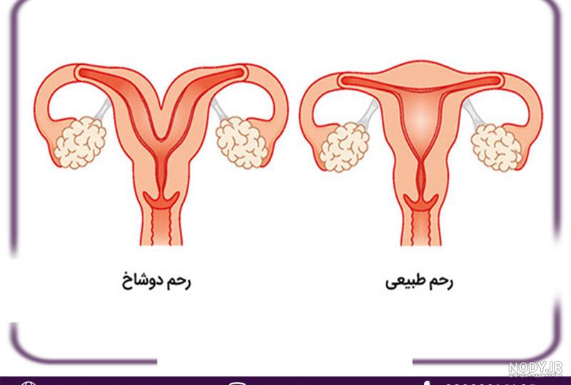 عکس های بارداری خارج از رحم عکس های بارداری خارج از رحم
