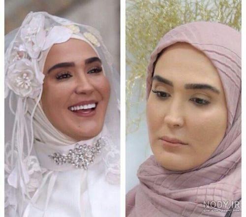 عکس های زهره فکور صبور در بیمارستان