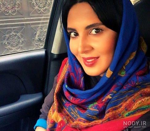 عکسهای نیوشا ضیغمی بعد از عمل دوم بینی